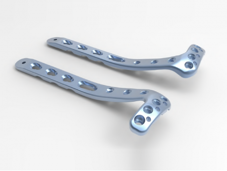 Proximal Lateral Tibial Locking Plate